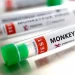 Monkeypox suspected cases rise to 141 in 13 States in Nigeria