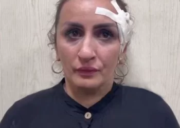 Mum accused of selling her five-day-old baby boy for £3,000 to pay for nose job