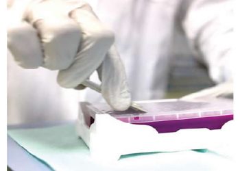 Travellers no longer require COVID-19 test- FG