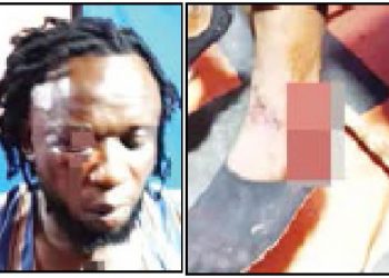 Ebonyi artiste beaten to a pulp over campaign song